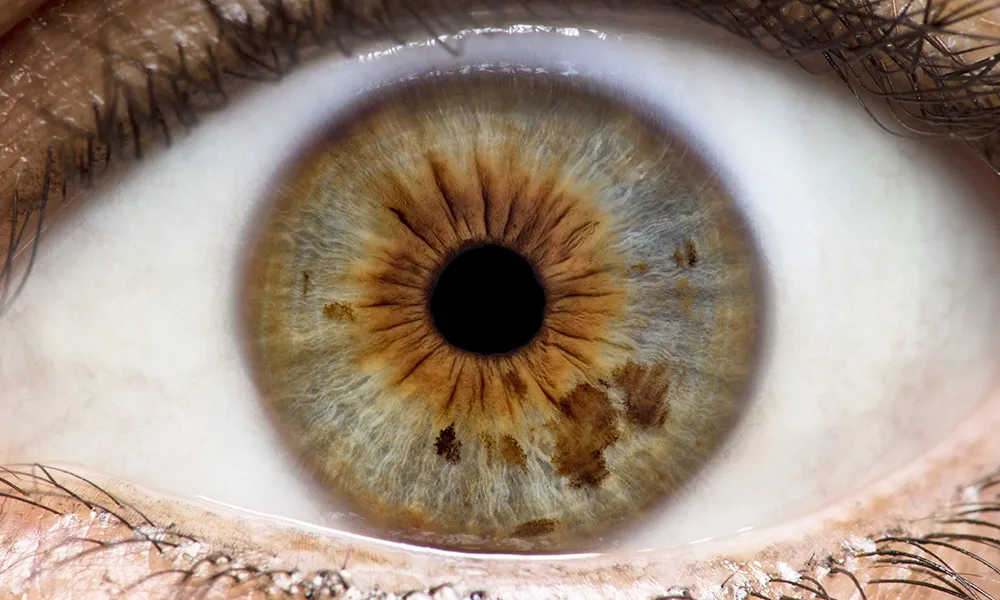Iridologia